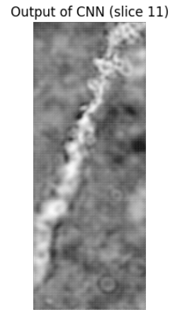 Dendrite